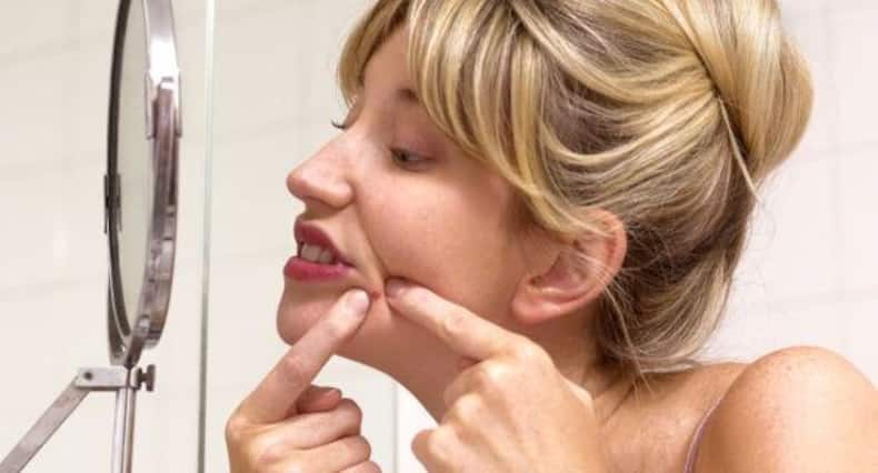 Acne breakout? Don't panic and follow these tips