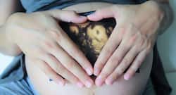 6 complications of gestational diabetes nobody tells you about