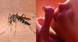How Zika virus stunts foetal brain development