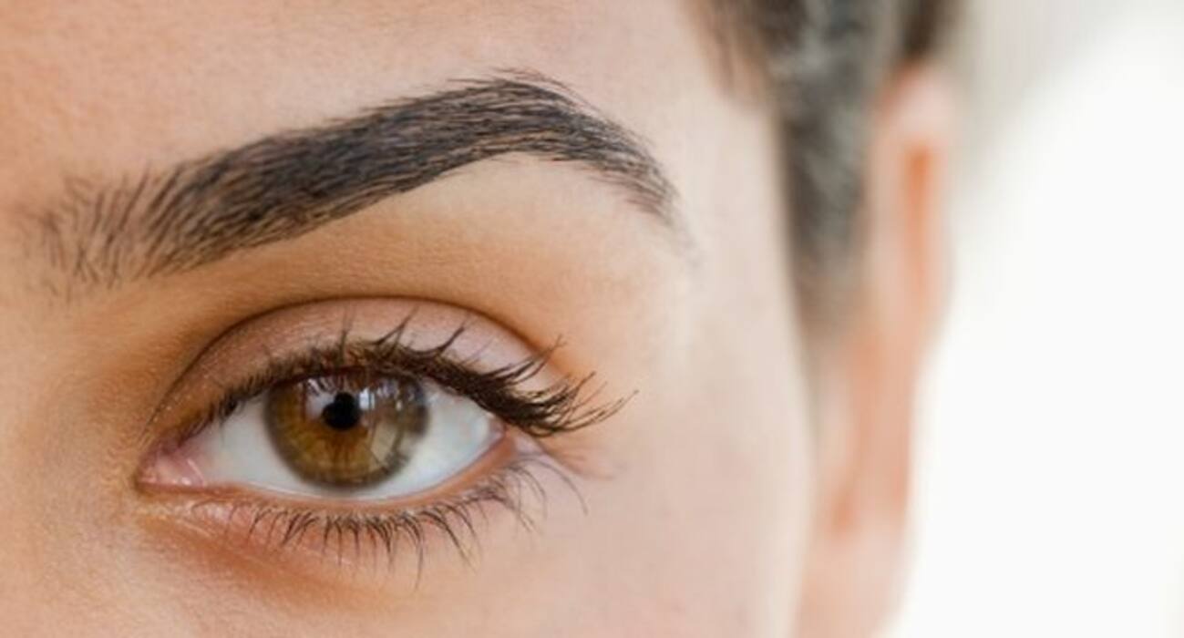 What causes acne on your forehead, eyebrows, cheeks, nose, upper lip and chin?