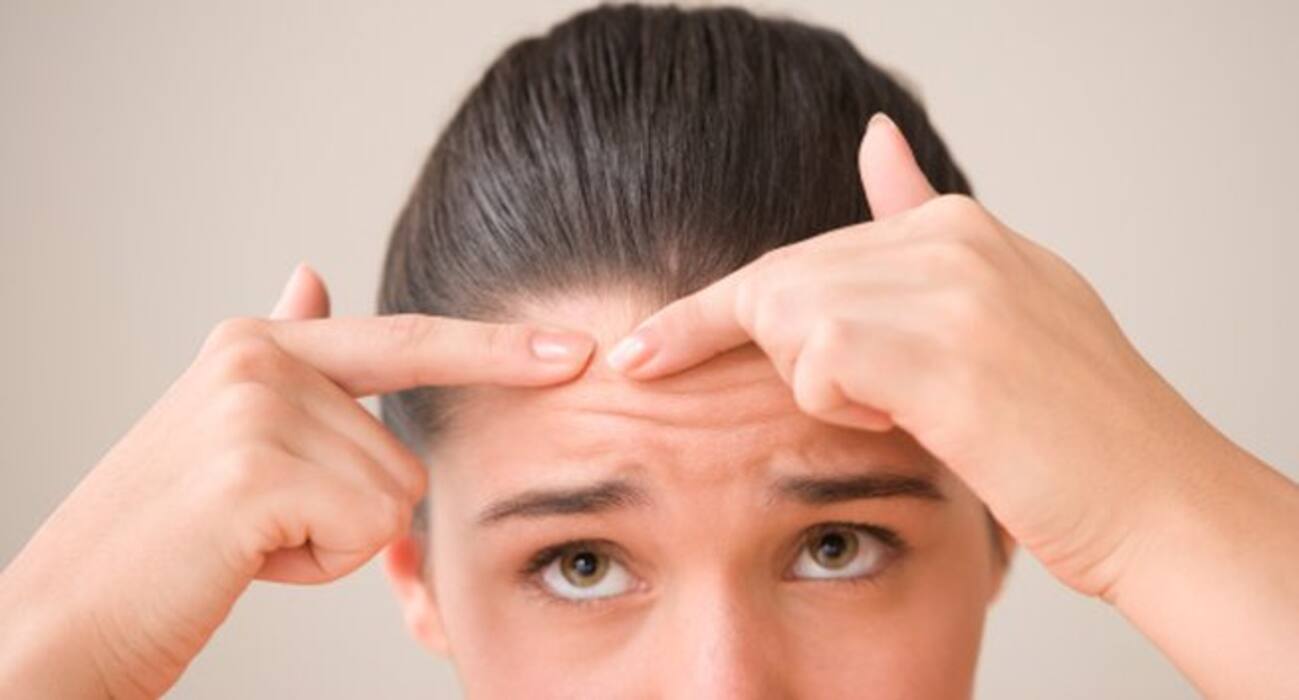 What causes acne on your forehead, eyebrows, cheeks, nose, upper lip and chin?