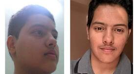 19-year-old Parag Doodhya loses 15 kg after fighting kidney disease