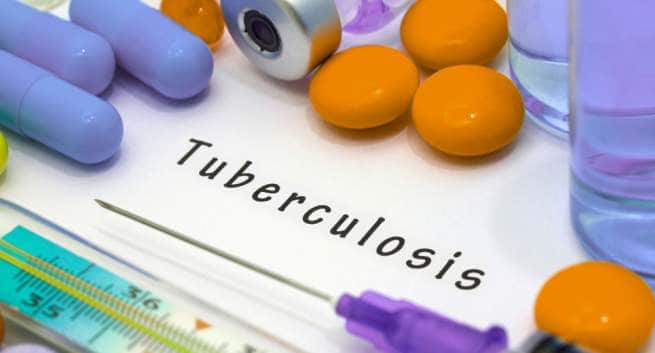 Biological markers in this blood test can help predict your risk of developing tuberculosis