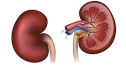 World Kidney Day 2016: Tips to prevent kidney problems & diseases