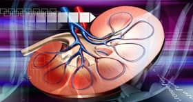 Inflammatory responses the key reason for diabetic and obesity related kidney disease