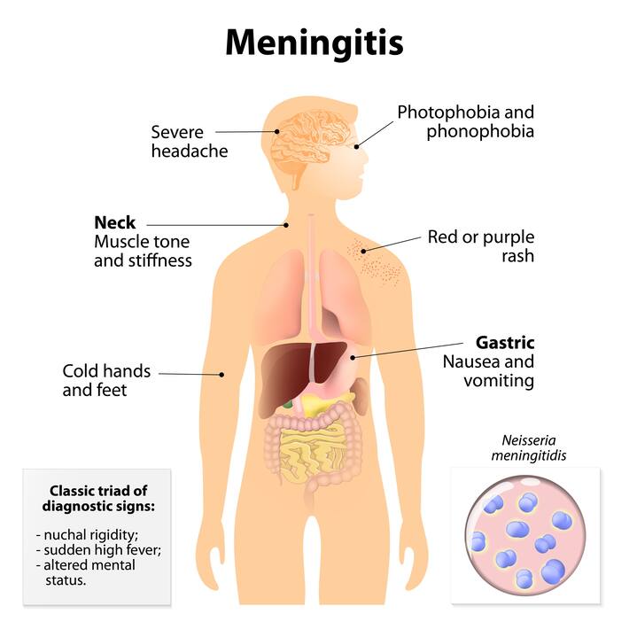 9-symptoms-of-syphilis-that-you-should-know-thehealthsite