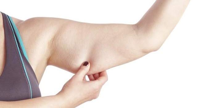 Arm-fat