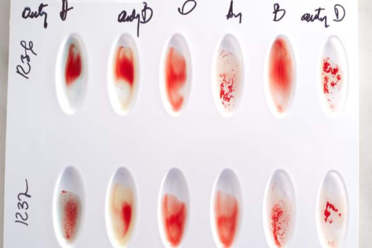 How to read your medical test report: Blood typing and blood cross