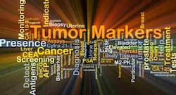 How to read your medical test report: Cancer screening blood tests