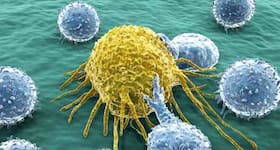 How Has Early Diagnosis Improved The Survival Rate Of Paediatric Cancer?