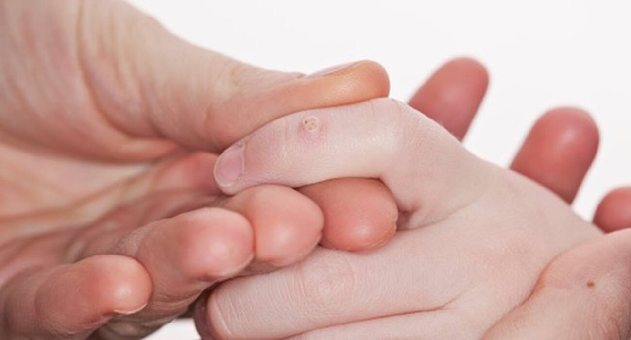 5 signs and symptoms of Human Papilloma Virus (HPV) you MUST be aware of!