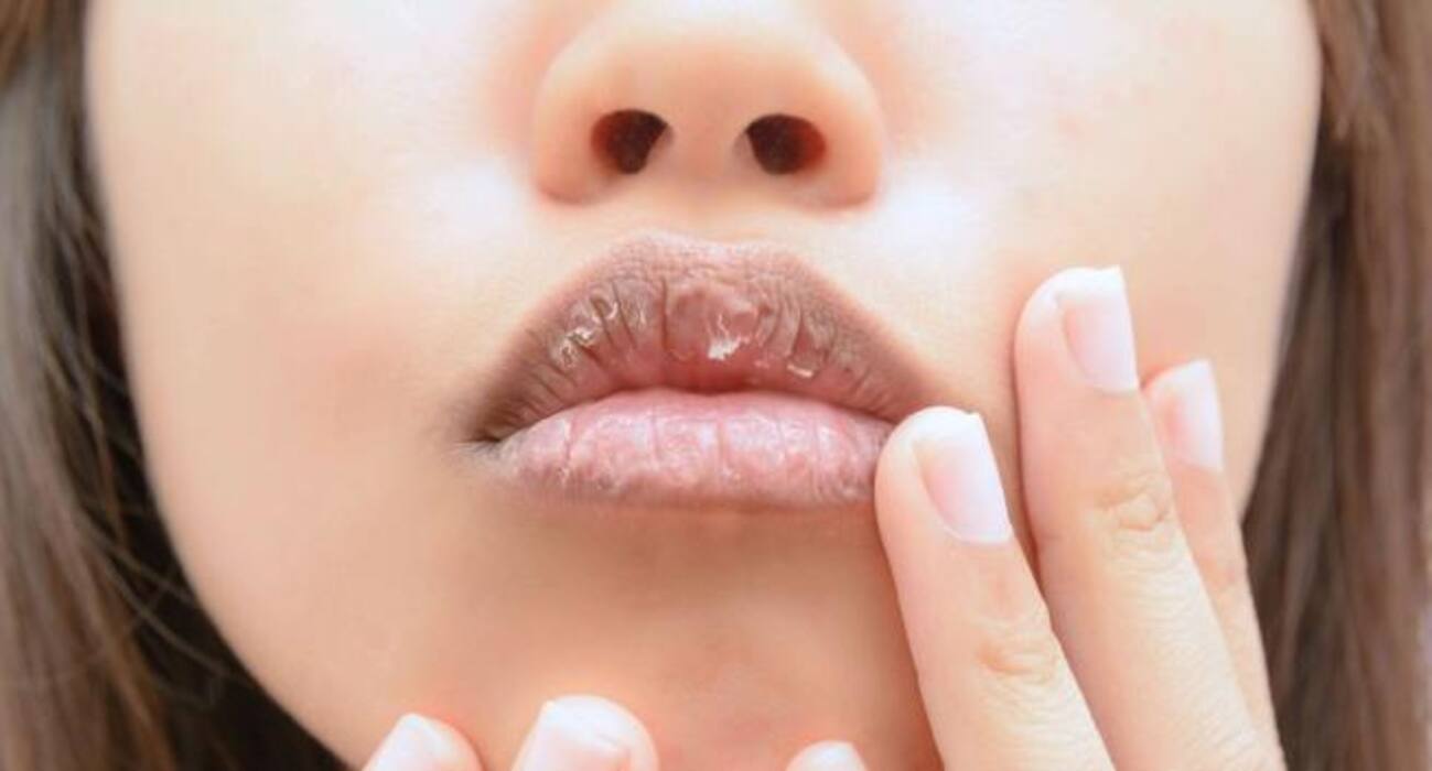 8 side-effects of antidepressants you should know about