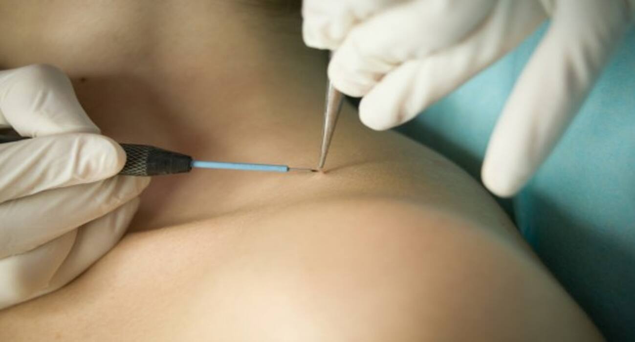 5 signs and symptoms of Human Papilloma Virus (HPV) you MUST be aware of!