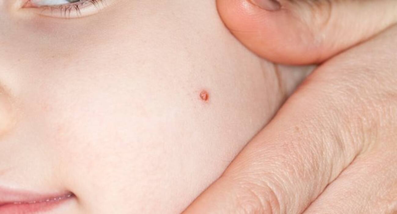5 signs and symptoms of Human Papilloma Virus (HPV) you MUST be aware of!