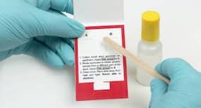 How to read your medical test report: Stool test
