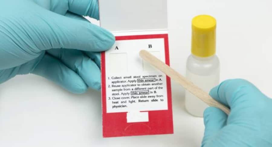 How to read your medical test report: Stool test