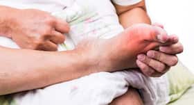 Low-protein diet plan for people suffering from gout