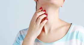 Prickly heat: try these Ayurveda home remedies to get quick relief