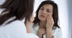 Thyroid Eye Disease: Understanding Symptoms, Diagnosis, And Management