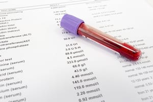 How to read your medical test report: Erythrocyte Sedimentation Rate (ESR)
