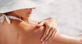 Dairy products will help soothe sunburn