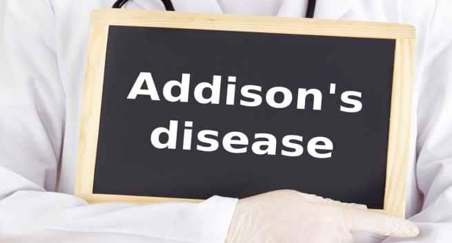 Weight loss fatigue 3 signs and symptoms of Addison s disease