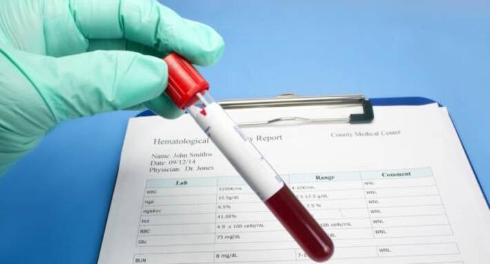 How to read your medical test report: Basic metabolic panel ...
