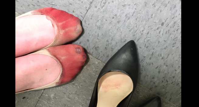 Heels or Flats? Your Health May Depend On It | The University of Arizona  Health Sciences