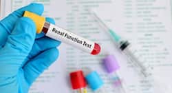 How to read your medical test report: Kidney function test