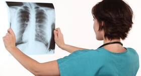 New model of tracking TB patients holds promise for India