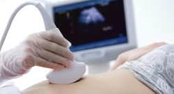 Does your anomaly scan say you have anterior placenta? Here's what you need to know