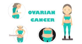 Ovarian cancer: What every woman needs to know Ovarian cancer: What every woman needs to know