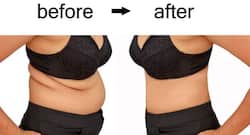 No diet, no exercise! Follow these simple weight loss tips to become slim and trim