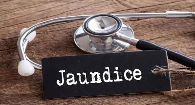 Ayurveda for jaundice - everything you should know