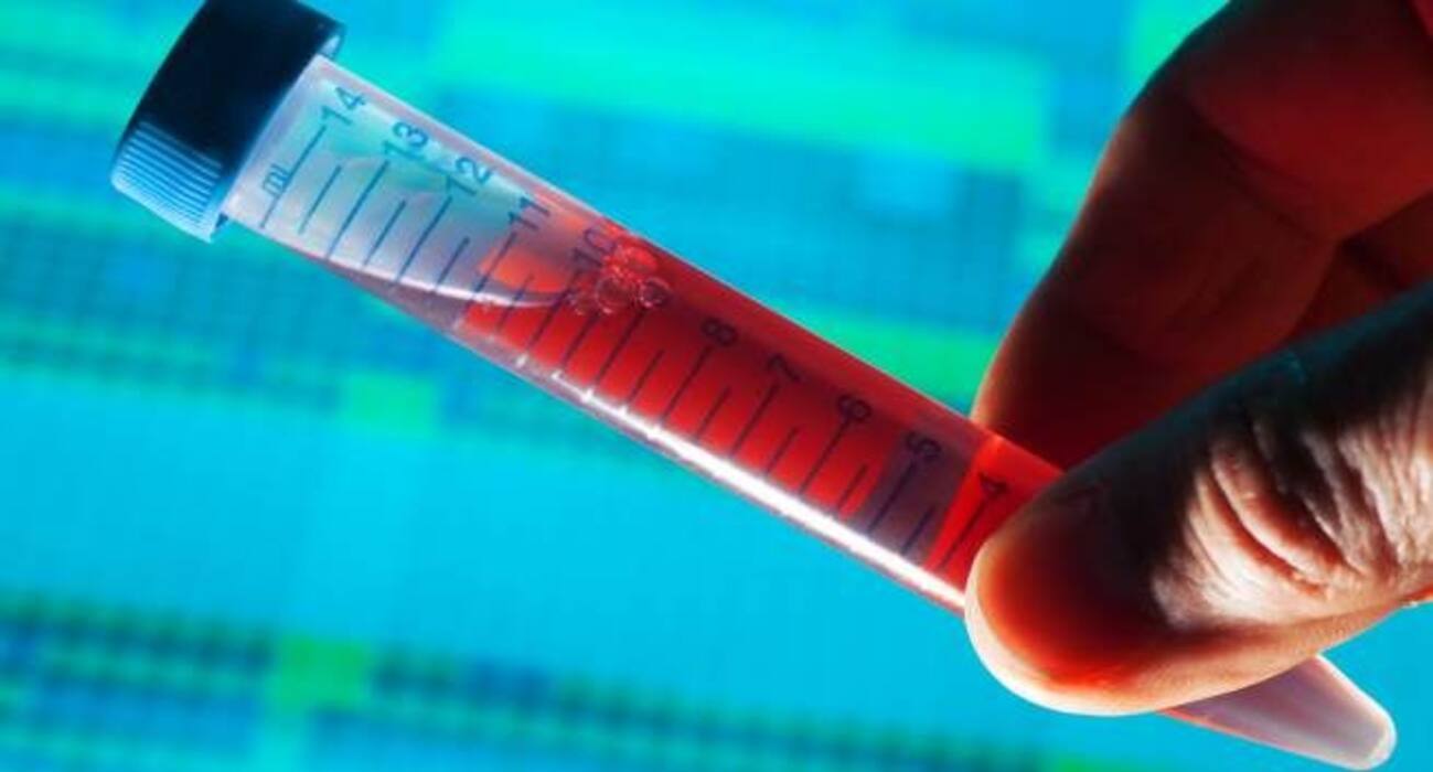10 expert tips for men to lower the risk of prostate cancer