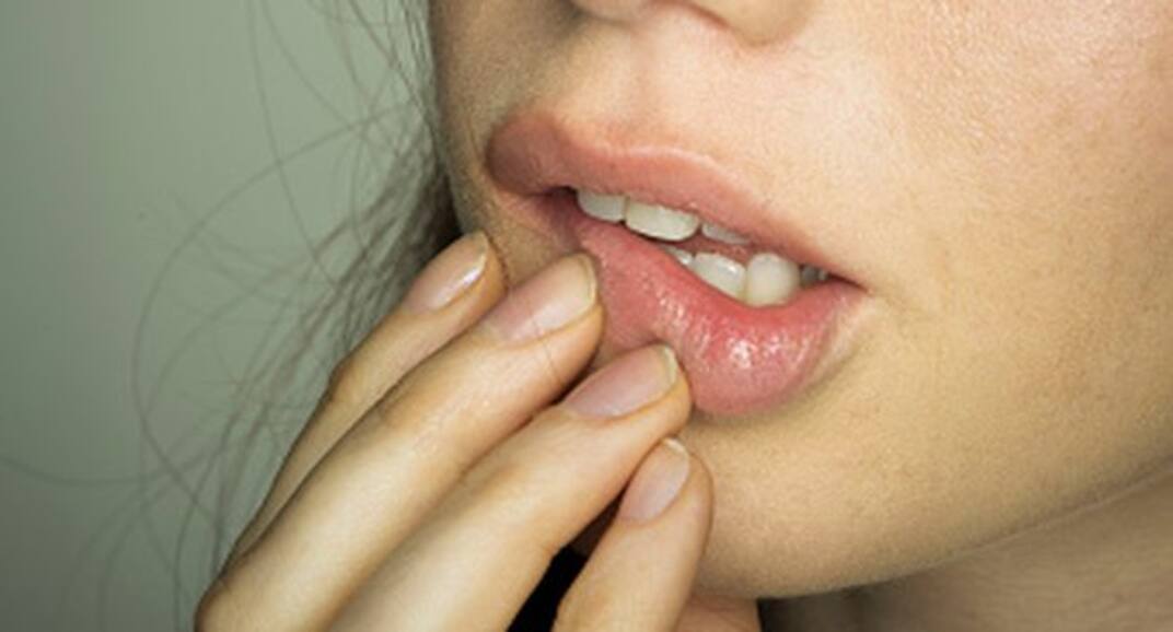 6 things your lips say about your health