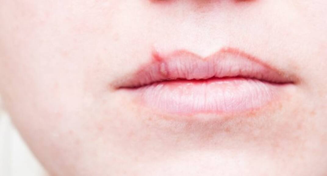 6 things your lips say about your health