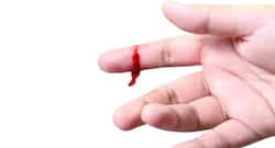 How to treat wounds (cut or scrape) at home?