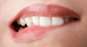 मुलायम होंठों के लिए सर्दियों में फॉलो करें ये एक्सपर्ट लिप केयर टिप्स