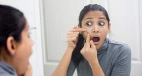 6 surprising reasons you get blackheads