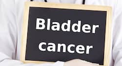Early menopause in smokers associated with bladder cancer