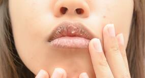 5 reasons you have a dry mouth (apart from dehydration)