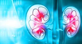 Belly fat affects the odds of women surviving kidney cancer