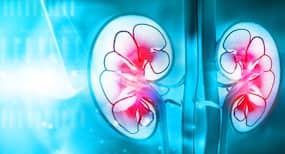 Belly fat affects the odds of women surviving kidney cancer