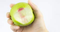 5 simple home remedies to deal with bleeding gums