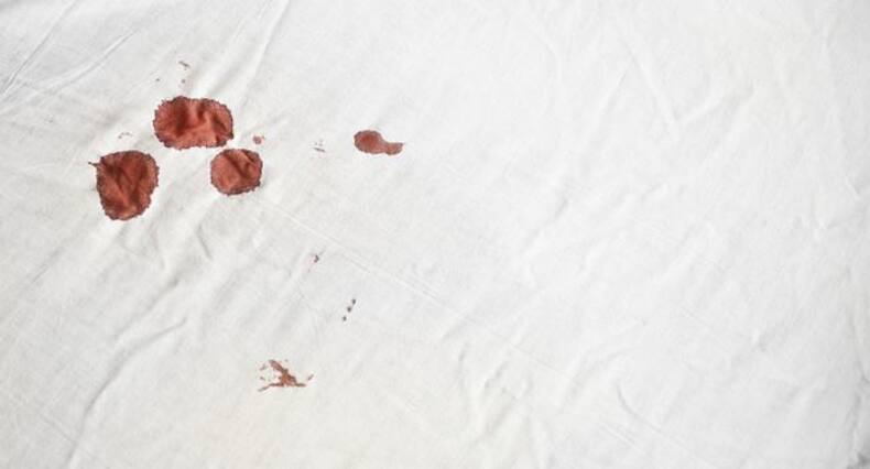 'Is my period normal?' Don't wonder, here are 6 signs of healthy periods!