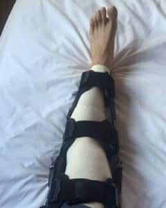 sachin tendulkar knee surgery