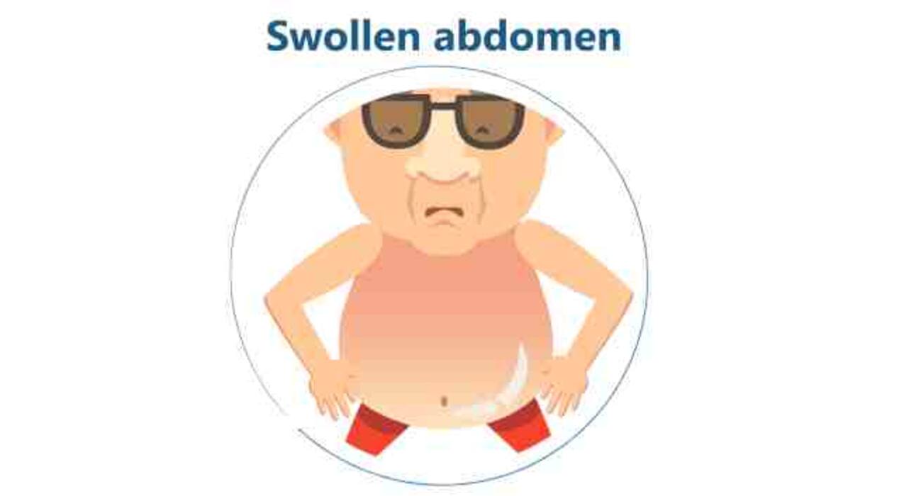 7 common signs and symptoms of liver cancer