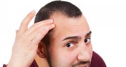 बाल झड़ने के ये भी हैं 5 बड़े कारण, ऐसे पाएं छुटकारा