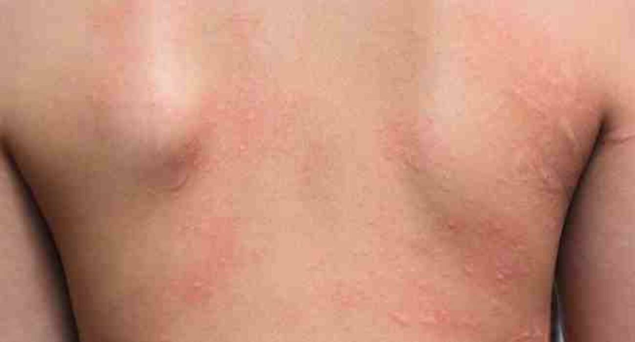 4 dangers of moisturisers you should know about